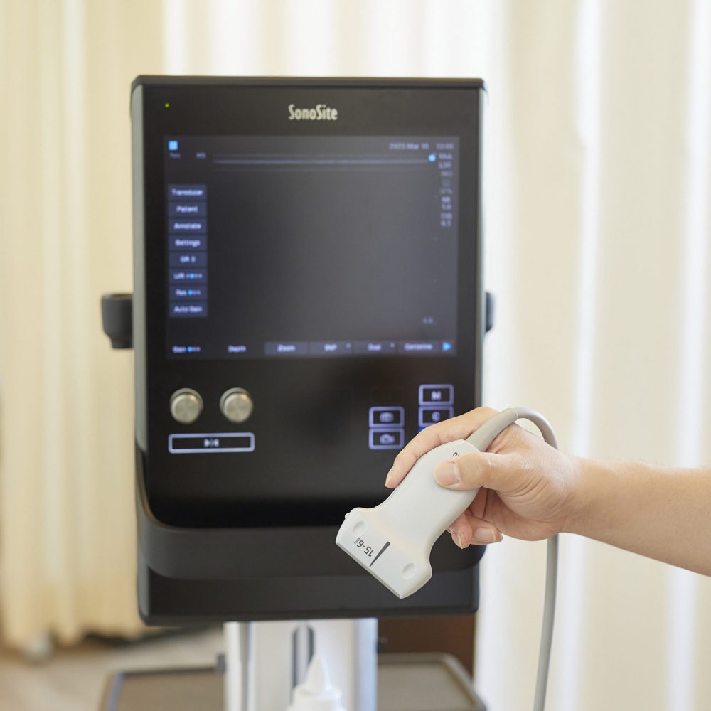 運動機能エコー写真